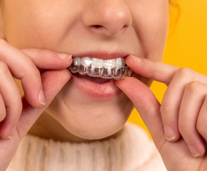 girl with invisalign